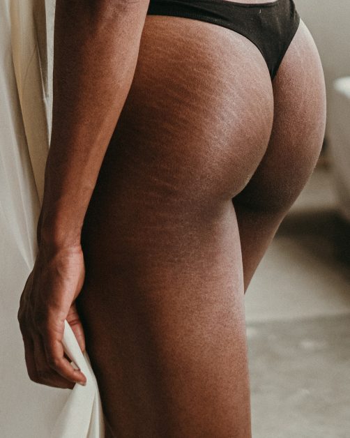 block image