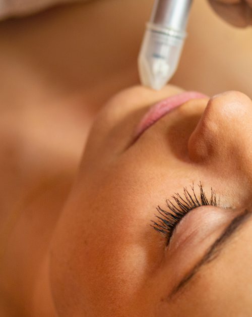 hydrafacial opiniones
