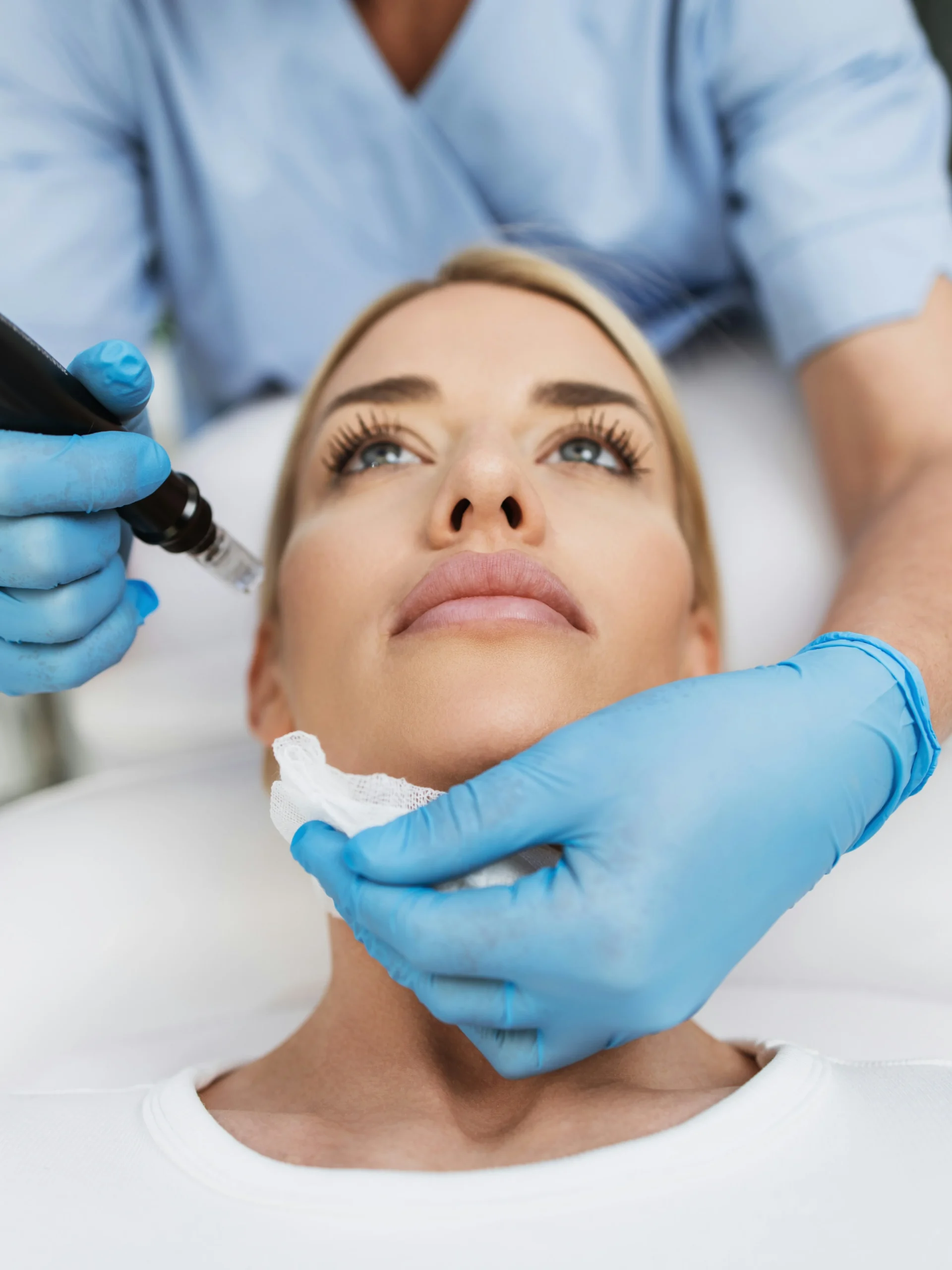 Primer plano del rostro de una mujer relajada en la camilla mientras recibe un tratamiento de microneedling en una clínica