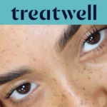Banner turquesa de Treatwell con un primer plano de pestañas con efecto lifting natural tras un lifting de pestañas coreano, sobre una piel con pecas
