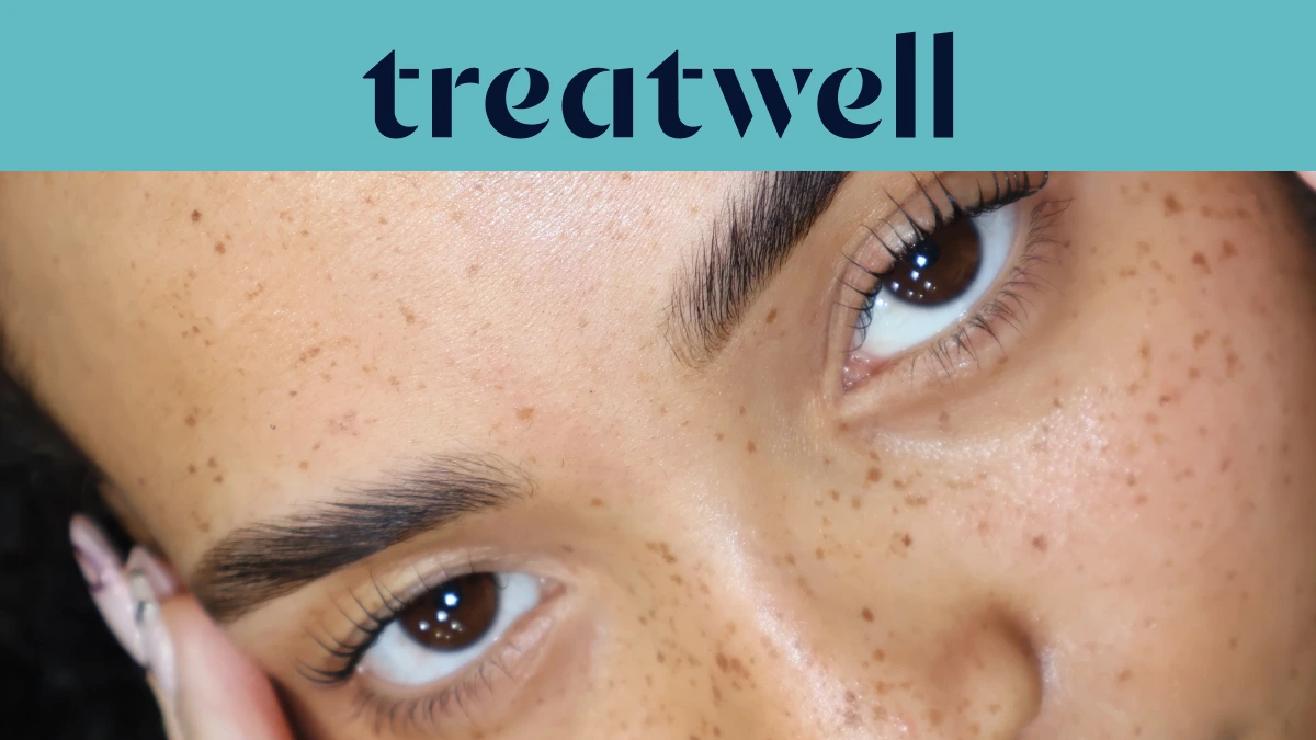 Banner turquesa de Treatwell con un primer plano de pestañas con efecto lifting natural tras un lifting de pestañas coreano, sobre una piel con pecas