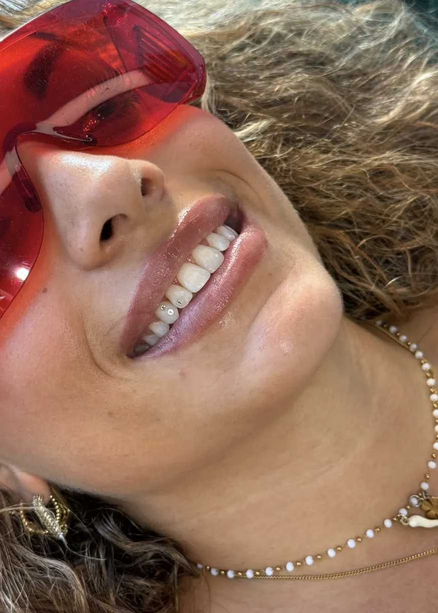Primer plano de una sonrisa con dos pequeñas gemas dentales de cristal en los dientes inferiores, retrato veraniego